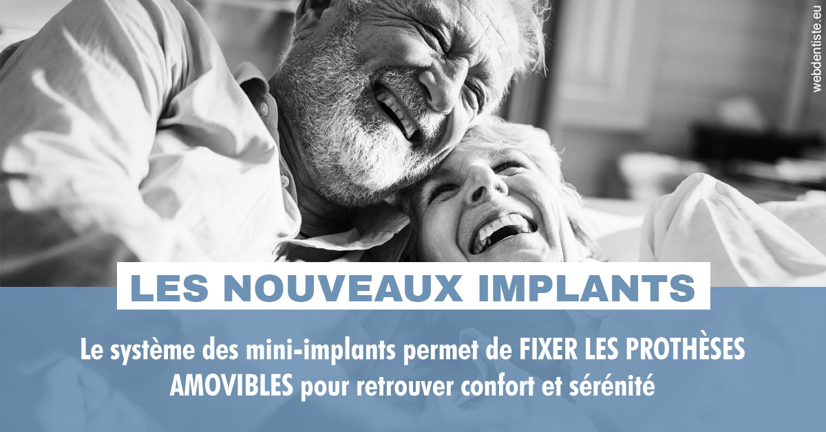 https://dr-luc-sebaoun-stephane.chirurgiens-dentistes.fr/Les nouveaux implants 2
