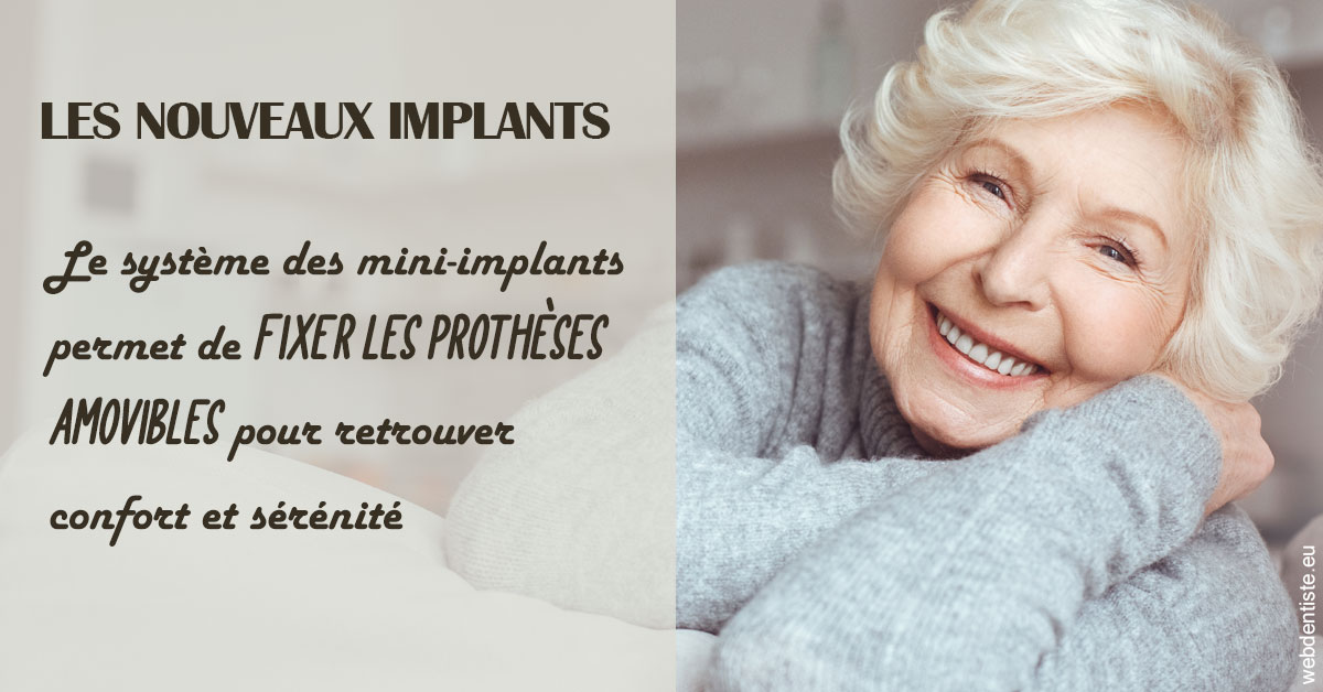 https://dr-luc-sebaoun-stephane.chirurgiens-dentistes.fr/Les nouveaux implants 1