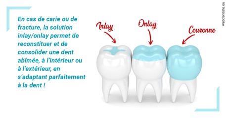 https://dr-luc-sebaoun-stephane.chirurgiens-dentistes.fr/L'INLAY ou l'ONLAY