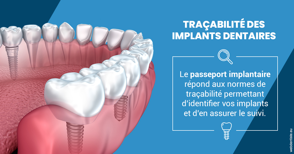 https://dr-luc-sebaoun-stephane.chirurgiens-dentistes.fr/T2 2023 - Traçabilité des implants 1