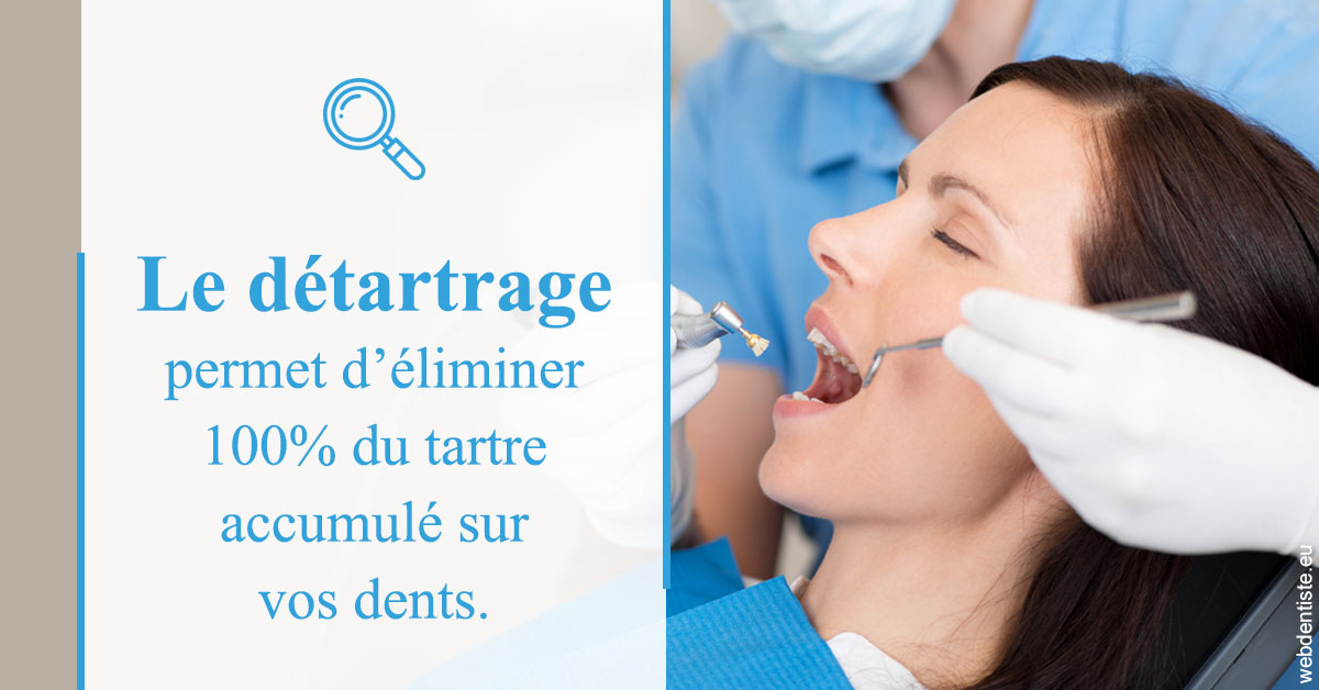 https://dr-luc-sebaoun-stephane.chirurgiens-dentistes.fr/En quoi consiste le détartrage