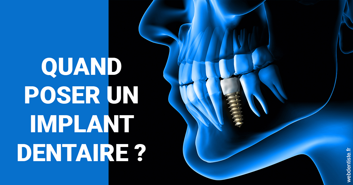 https://dr-luc-sebaoun-stephane.chirurgiens-dentistes.fr/Les implants 1