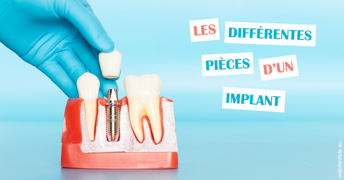 https://dr-luc-sebaoun-stephane.chirurgiens-dentistes.fr/Les différentes pièces d’un implant 2