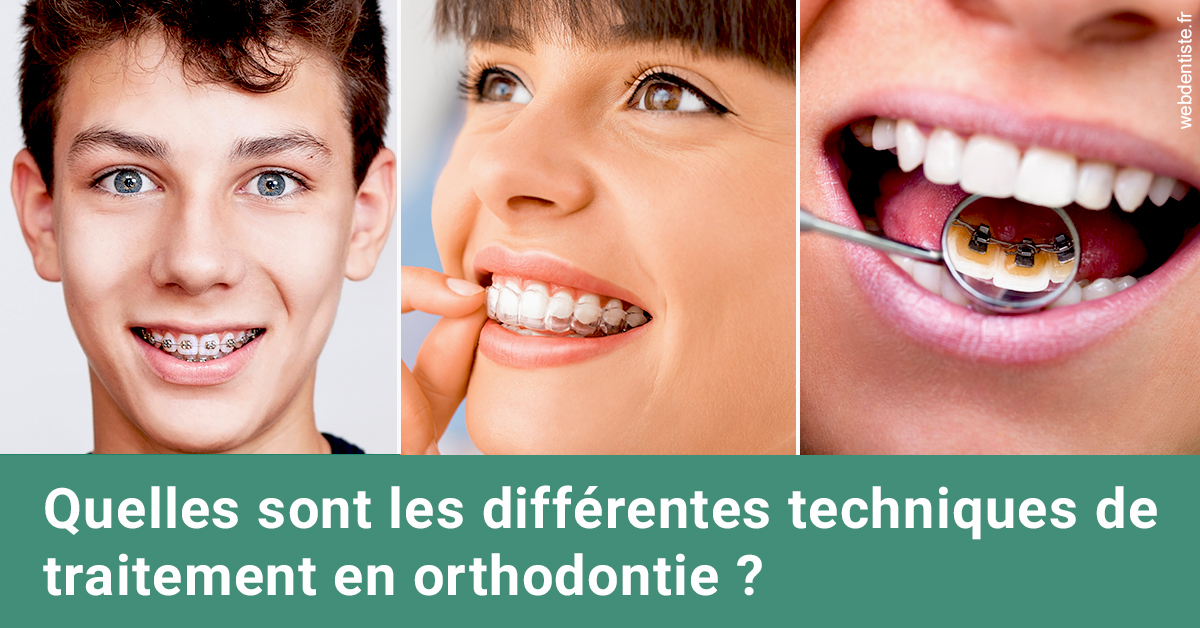 https://dr-luc-sebaoun-stephane.chirurgiens-dentistes.fr/Les différentes techniques de traitement 2