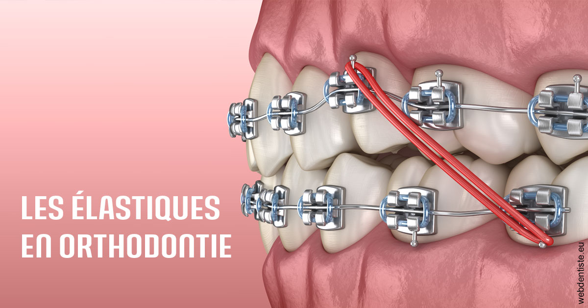 https://dr-luc-sebaoun-stephane.chirurgiens-dentistes.fr/Elastiques orthodontie 2