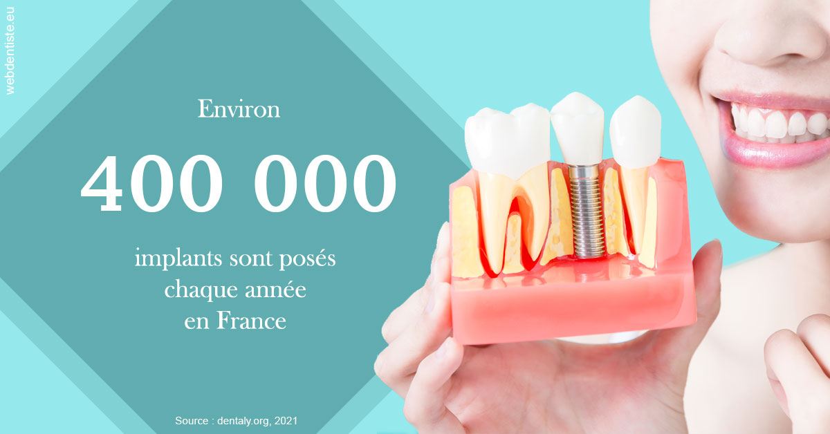 https://dr-luc-sebaoun-stephane.chirurgiens-dentistes.fr/Pose d'implants en France 2